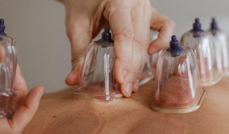 Schröpfen 1130 Wien, 13. Bezirk Schröpfen 1130 Wien, 13. Bezirk